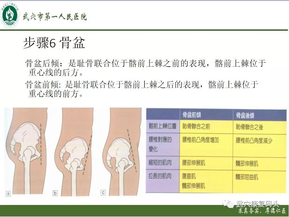 通草的功效与作用能通输卵管堵塞,权威评估解析_定制版76.196